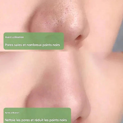 Diystar™ 100% Natural Green Tea Deep Cleansing Mask