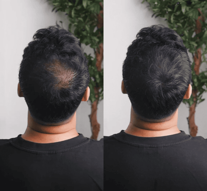 GROWY™ Poudre capillaire - Achetez-en 1 et recevez-en 2