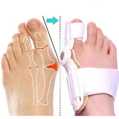 Correcteur rotatif d’oignons unisexe – Ajustement parfait – achetez-en 1 et recevez-en 2